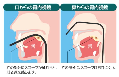 経口・経鼻内視鏡の断面図